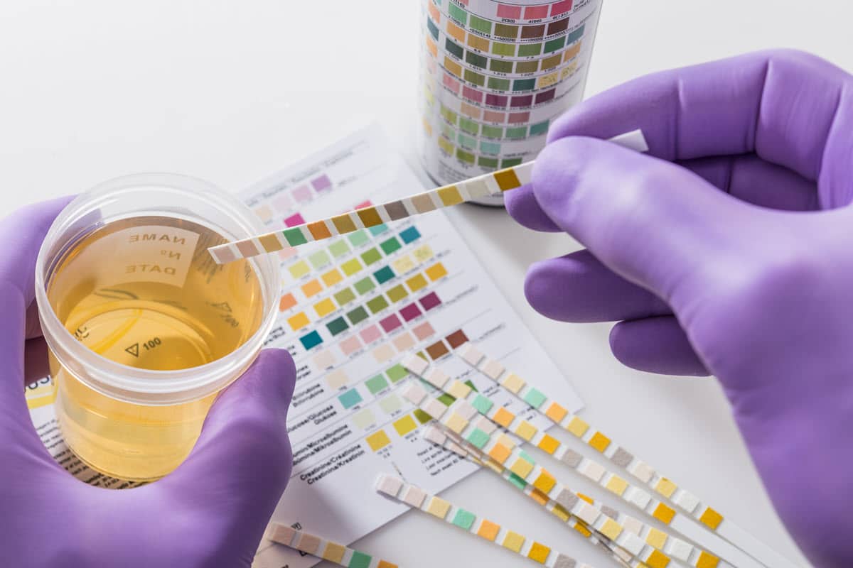 person performing a drug test with a cup of urine