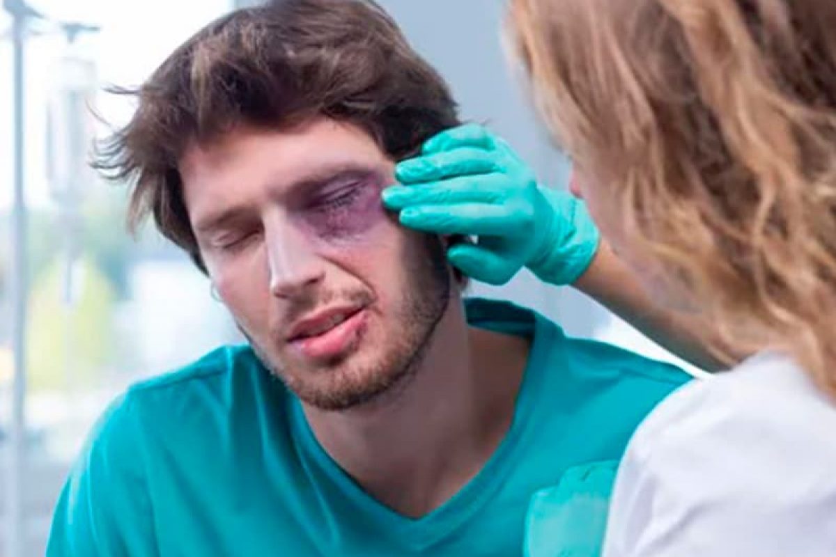 a doctor looking at a man with a black eye